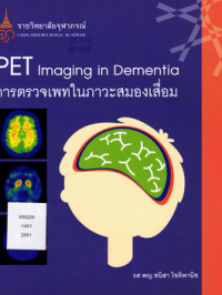 การตรวจเพทในภาวะสมองเสื่อม = PET imaging in dementia