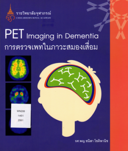 การตรวจเพทในภาวะสมองเสื่อม = PET imaging in dementia Image 1
